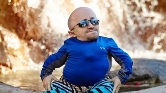 Hai avuto una brutta giornata? Guarda questo video di Sean Stephenson, solo due minuti…